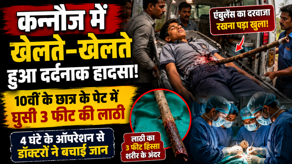 कन्नौज में गुल्ली-डंडा खेलते समय 10वीं के छात्र के पेट में घुसी लाठी