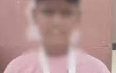आगरा में 7वीं के छात्र का टीचर ने तोड़ा हाथ:बेरहमी से की पिटाई, मामला डीसीपी तक जाने के 6 दिन बाद हुई FIR
