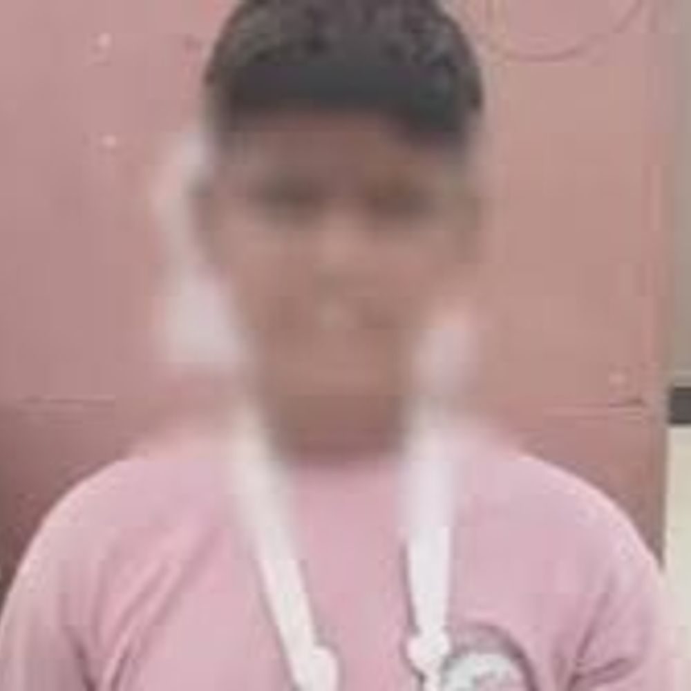 आगरा में 7वीं के छात्र का टीचर ने तोड़ा हाथ:बेरहमी से की पिटाई, मामला डीसीपी तक जाने के 6 दिन बाद हुई FIR