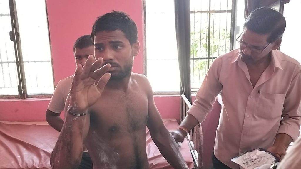 Auraiya News: खाना बनाते समय सिलिंडर में लगी आग, तीन युवक झुलसे