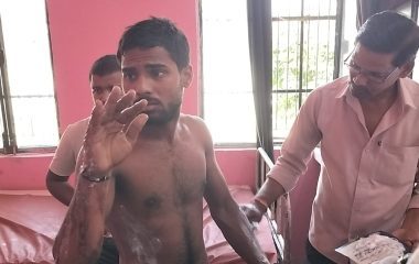 Auraiya News: खाना बनाते समय सिलिंडर में लगी आग, तीन युवक झुलसे
